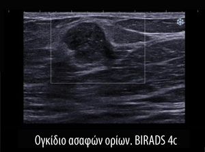 Υπερηχογράφημα BIRADS Υπερηχογράφημα BIRADS